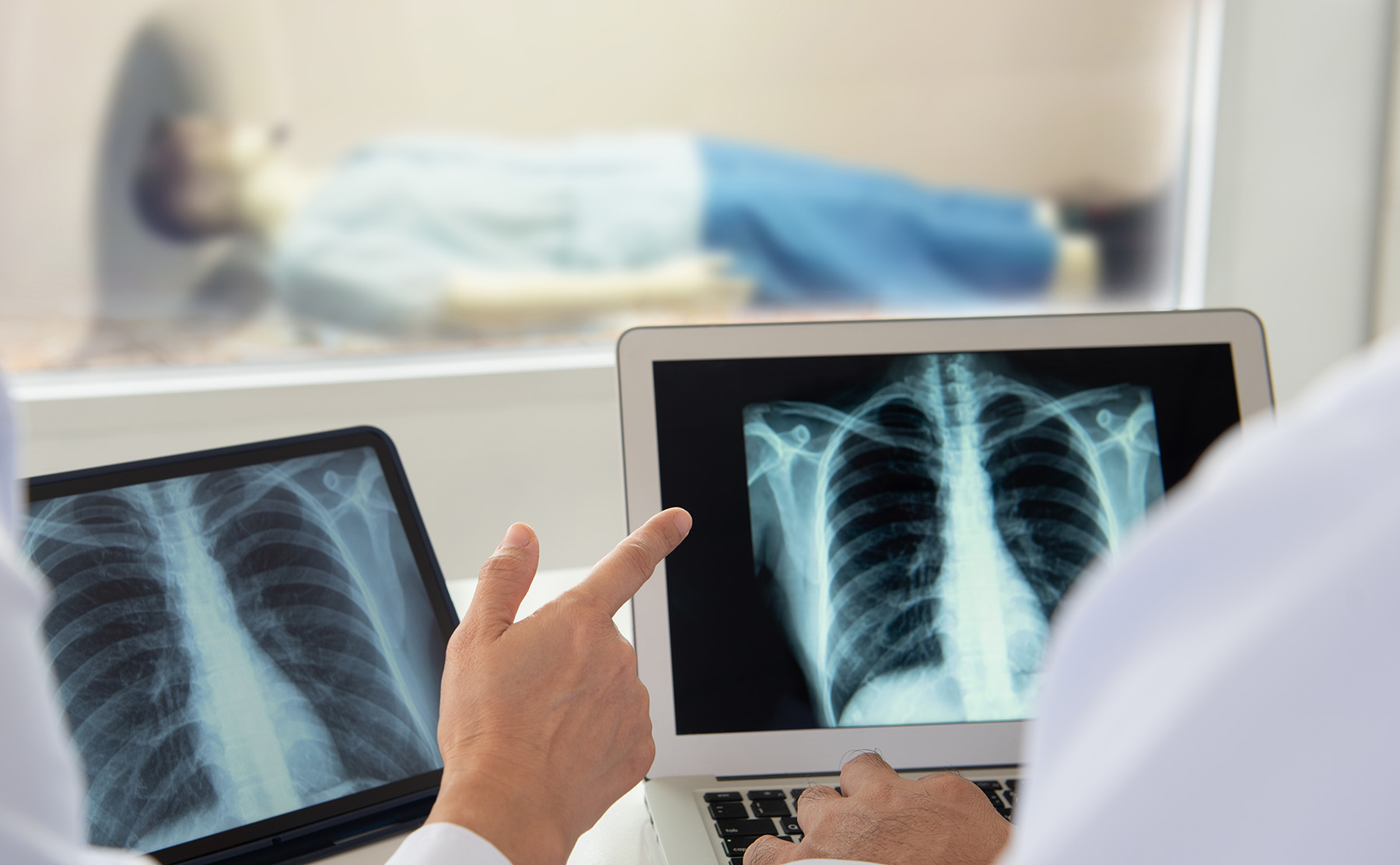 3 Reasons Optimized Trials Are Ideal for Pulmonary and Respiratory Research